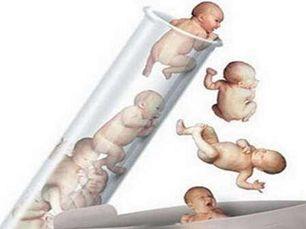 体外受精 IVF-ET